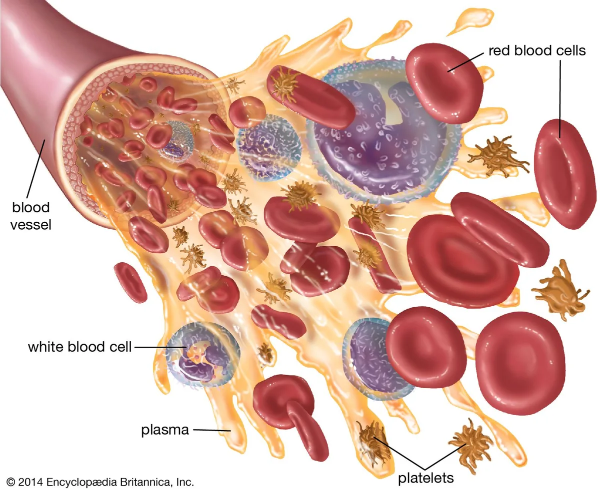 blood clot
