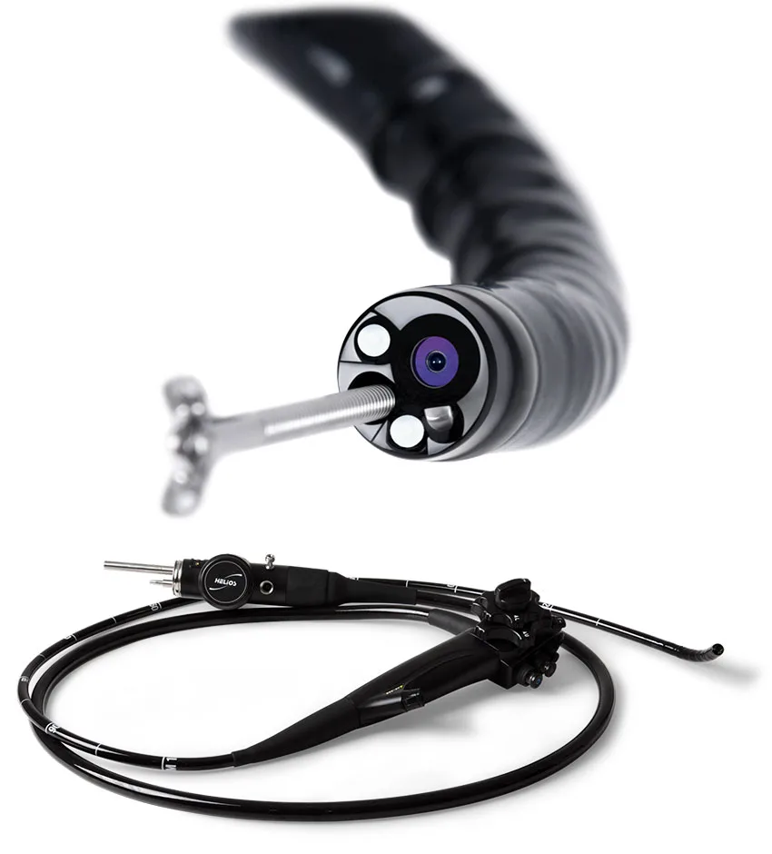 endoscopy